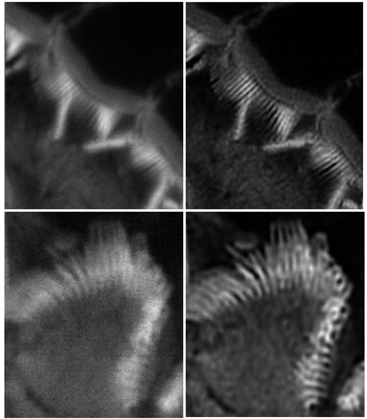 Point-scan confocal, 100x 1.49 Oil objective, Ear stereocilia sample, MAP deconvolution. Deconvolution recovers details around 120 nm, which are below the diffraction limit of the microscope. blurring