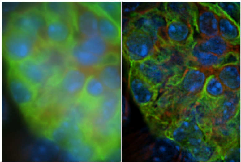 Wide-field, 40x 1.15 Water objective, Kidney slice sample, MAP deconvolution. Deconvolution correctly redistributes light to reveal previously obscured fine sample structures. out-of-focus light