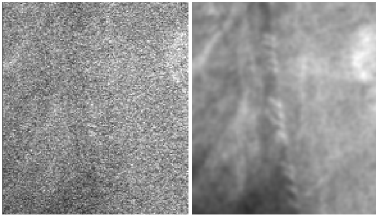 Point-scan confocal, 10x 0.45 Objective, Daphnia sample, MAP deconvolution. Deconvolution utilizes information from a large 3D neighborhood to dramatically increase the signal to noise ratio of the image. corrupted by noise