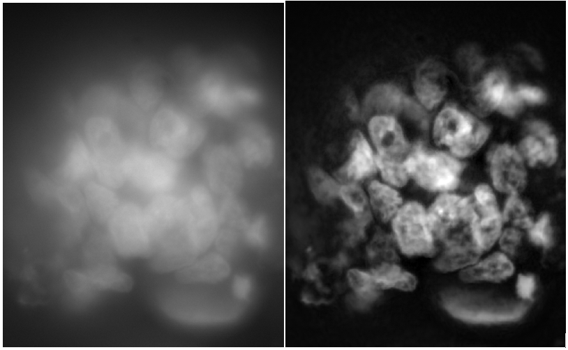 Wide-field, 60x 1.2 Water objective, Organoid sample, Clarify.ai. clarify