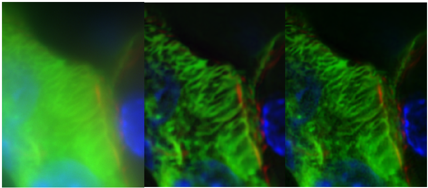 Wide-field, 100x 1.45 Oil objective, Kidney slice sample, Clarify.ai, Restore.ai. Compared to Clarify.ai, Restore.ai is capable of recovering more sample details. restore