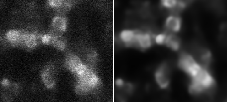 AX resonant before/after